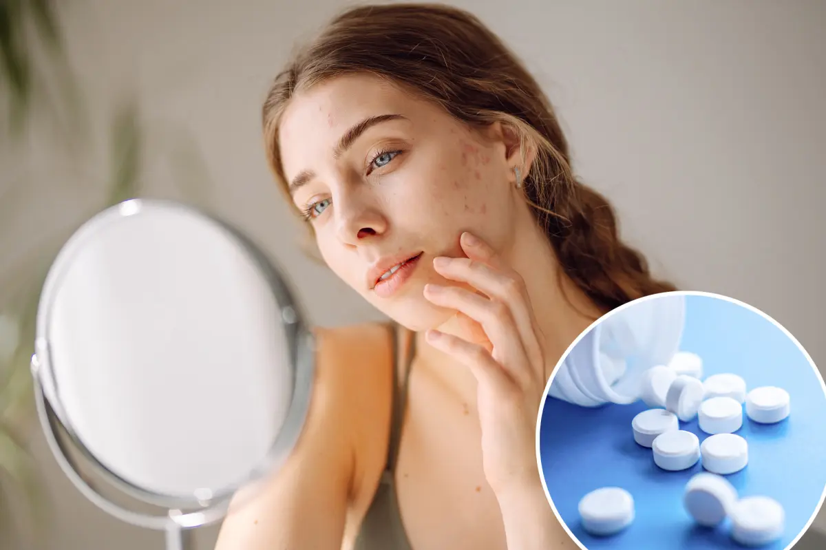 Do you have ‘ferritin face’? The mineral deficiency that could be messing with your looks - New York Post