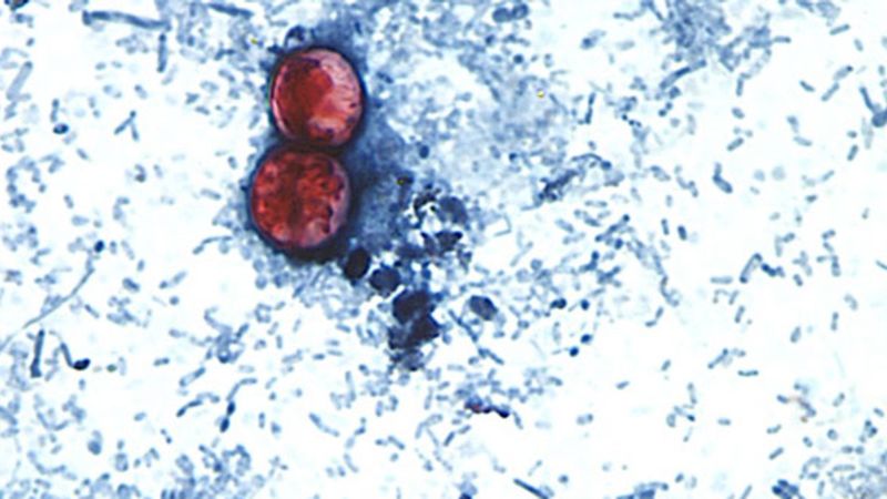 First deaths reported in cyclosporiasis outbreak - CNN